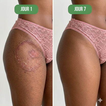 Celneo® – Savon Antifongique